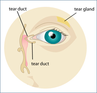 Dry Eye Syndrome South Florida