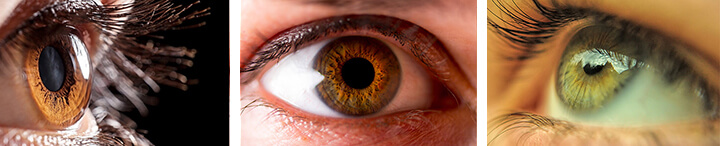 Corneal Disorders Margate